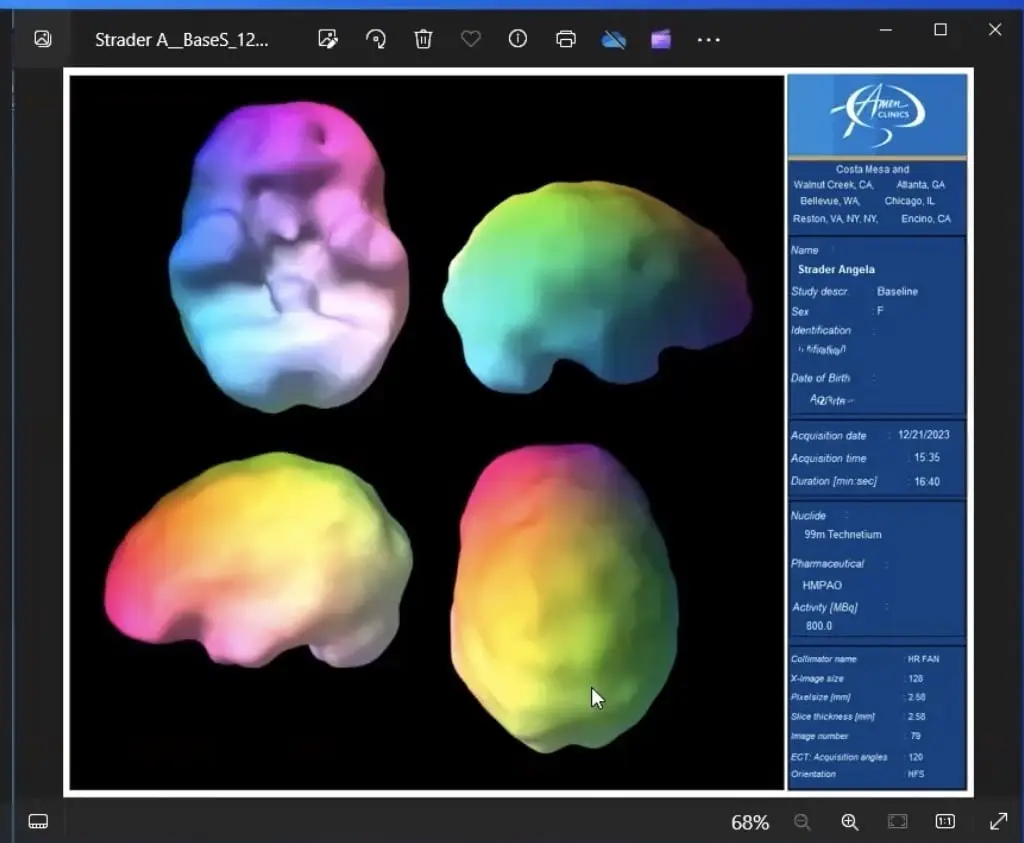 Image of a four parts of the brain